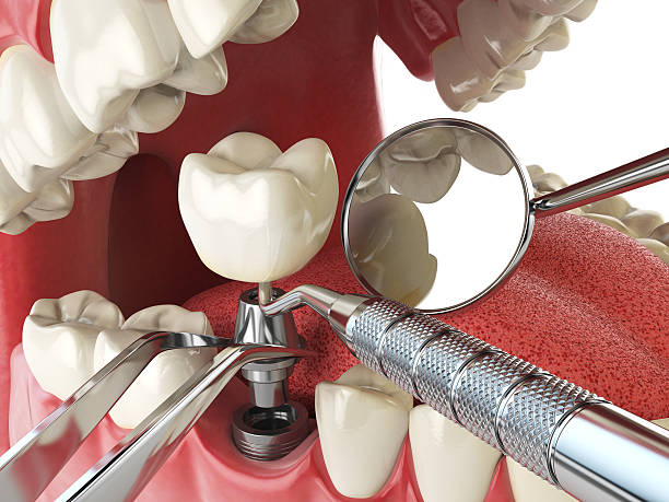 Professional Emergency Dental Service in FL